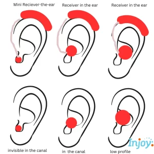 A diagram of the different types of hearing aids. 