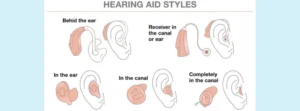 A chart of hearing aid styles. 